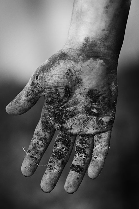 dirty hand